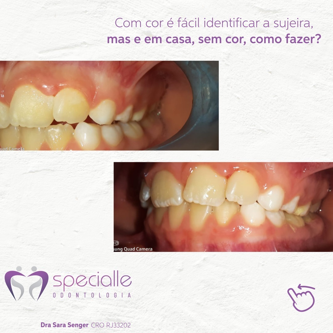 COM COR É FACIL IDENTIFICAR A SUJEIRA, MAS E EM CASA, SEM COR, COMO FAZER?
