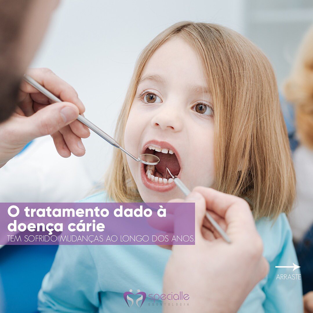 OTRATAMENTO DADO À DOENÇA CÁRIE