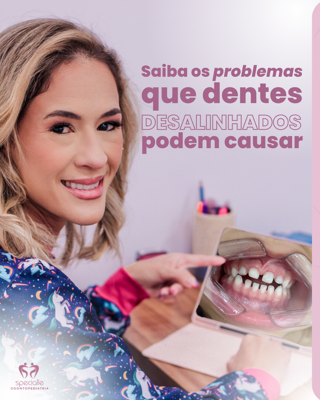 Saiba os problemas que os dentes desalinhados podem causar
