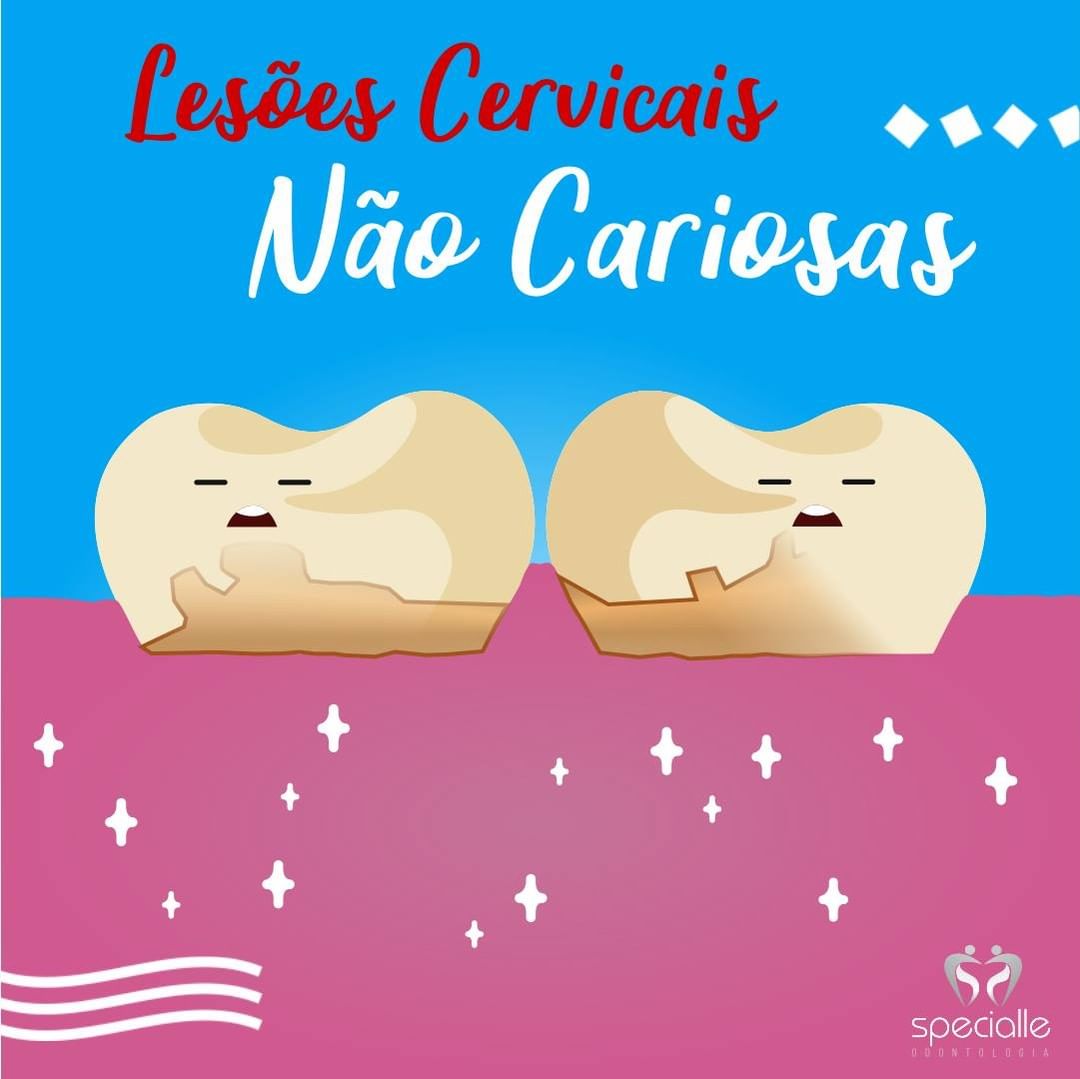 Lesões Cervicais Não Cariosas