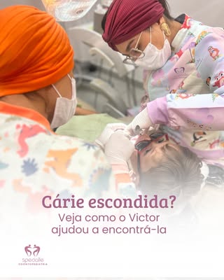 Cáries interproximais: o perigo silencioso entre os dentes das crianças